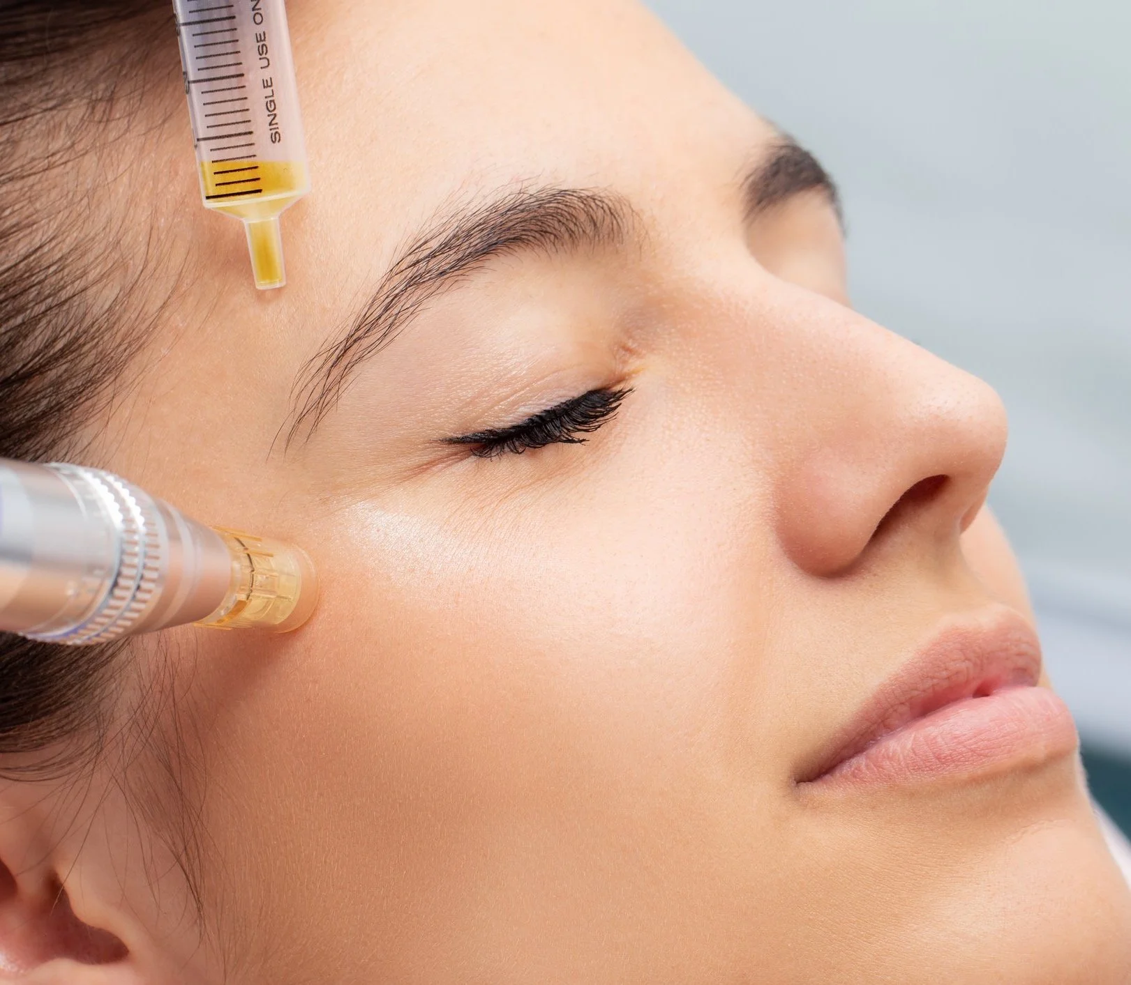A doctor holding a vial of Platelet-Rich Plasma (PRP) next to a patient receiving microneedling on their face. The image shows the process of the 'Vampire Facial'.