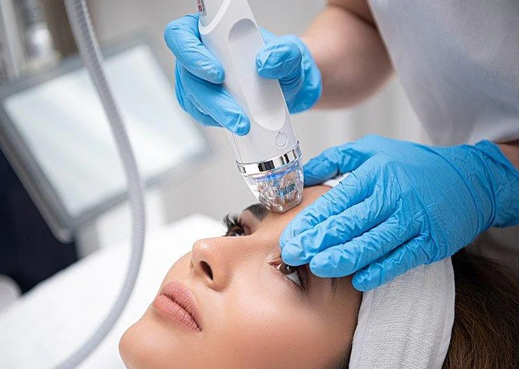 A close-up of a radiofrequency microneedling device being used on a person's skin. The device has multiple tiny needles emitting RF energy.