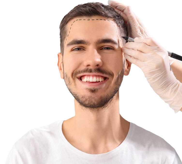 What is FUE Hair Transplant