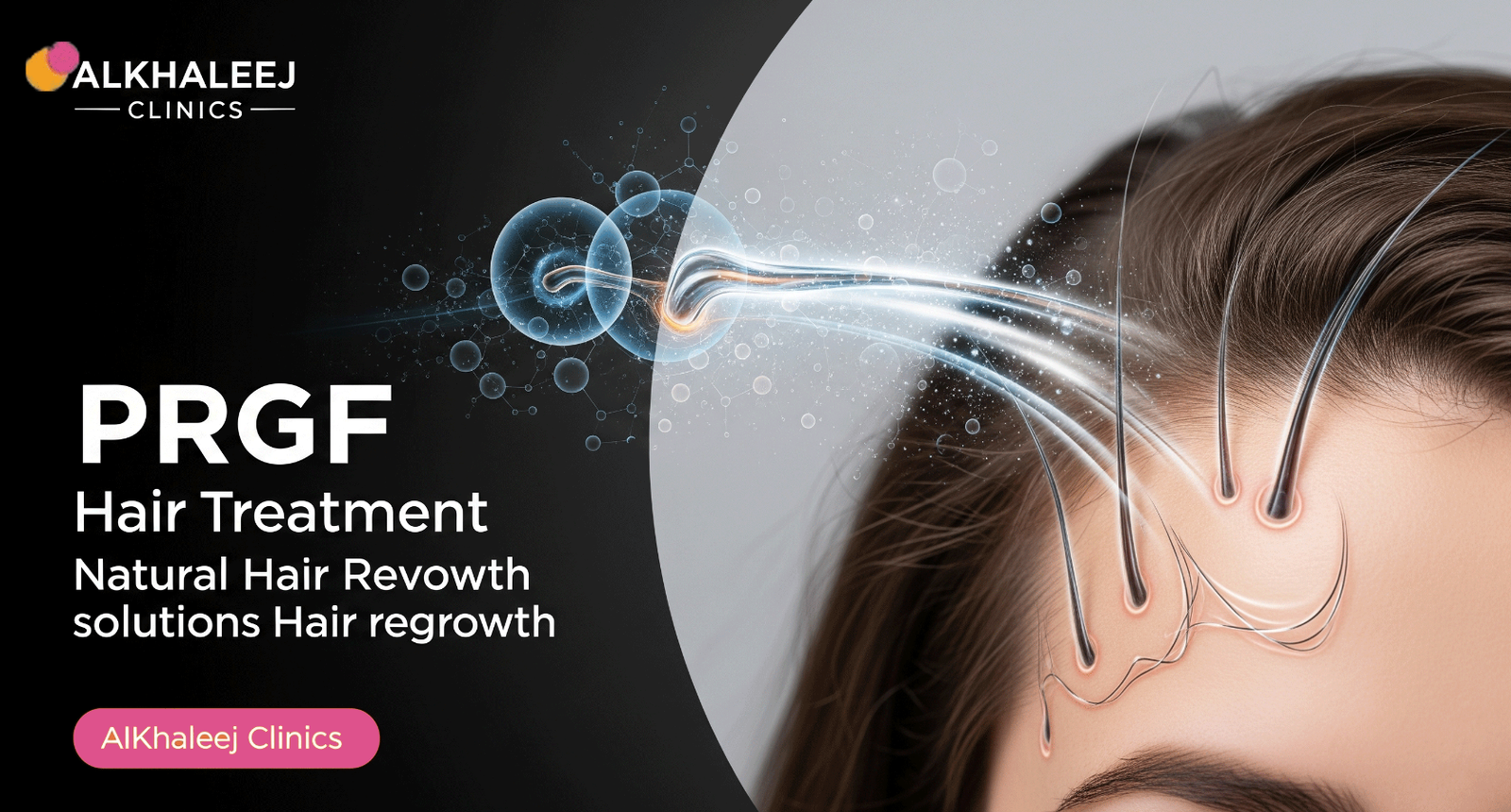 PRGF Hair Treatment at AlKhaleej Clinics