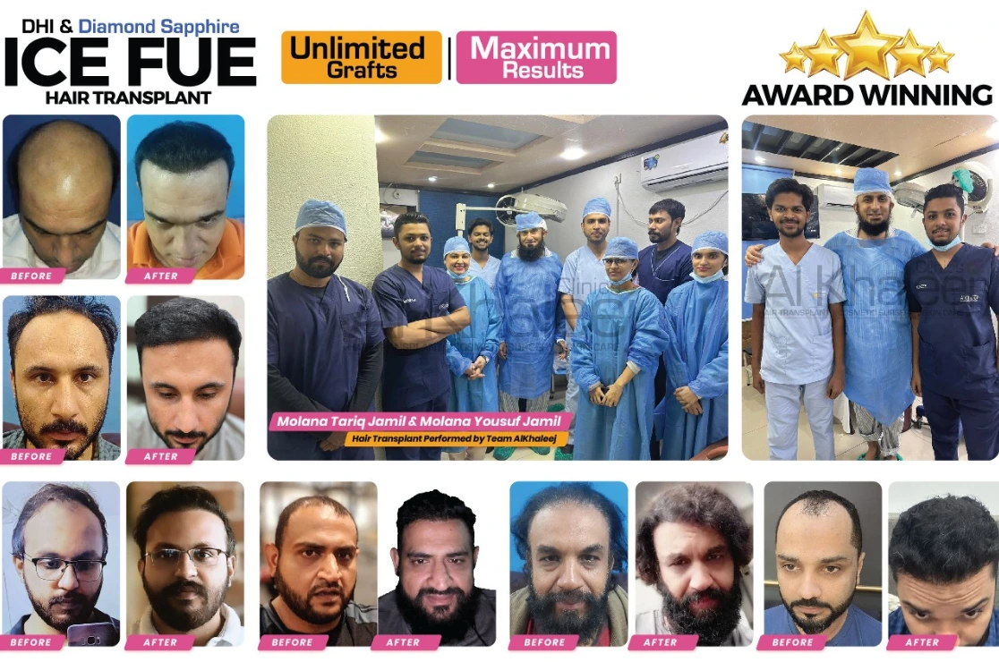 100% Satisfied Hair Transplant Patients Feedback